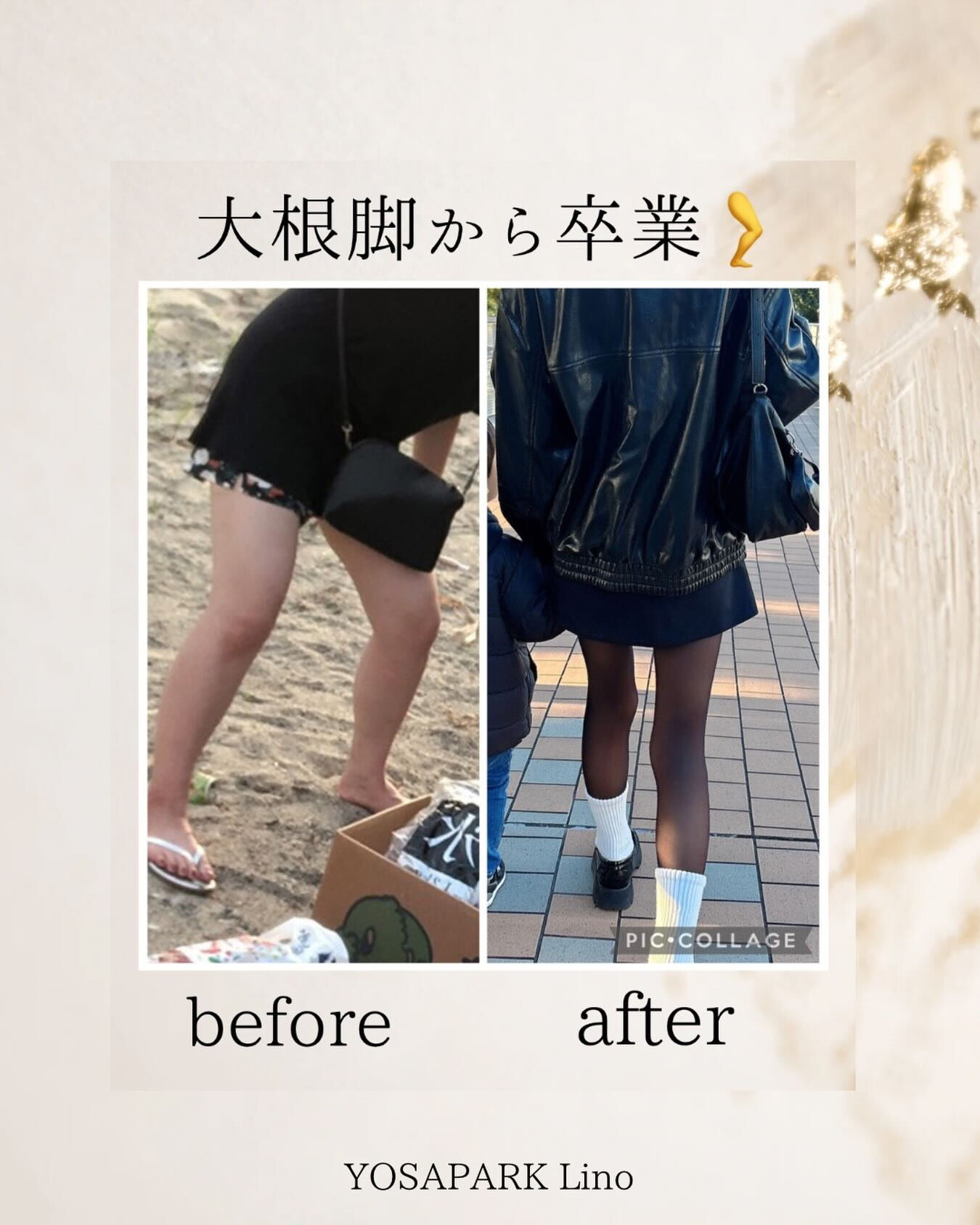 大根脚から卒業🦵